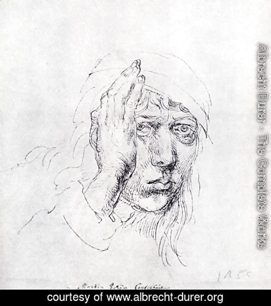 Albrecht Durer - Self-Portrait with Bandage